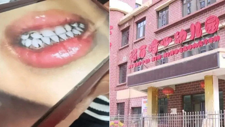 甘肃天水通报：幼儿园厨师掺颜料致247名幼儿血铅异常，6人被批捕、17人被立案