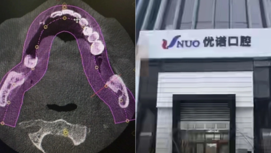 哈尔滨77岁老人一次性拔12颗牙种6颗后身亡 涉事医院 医生已停诊