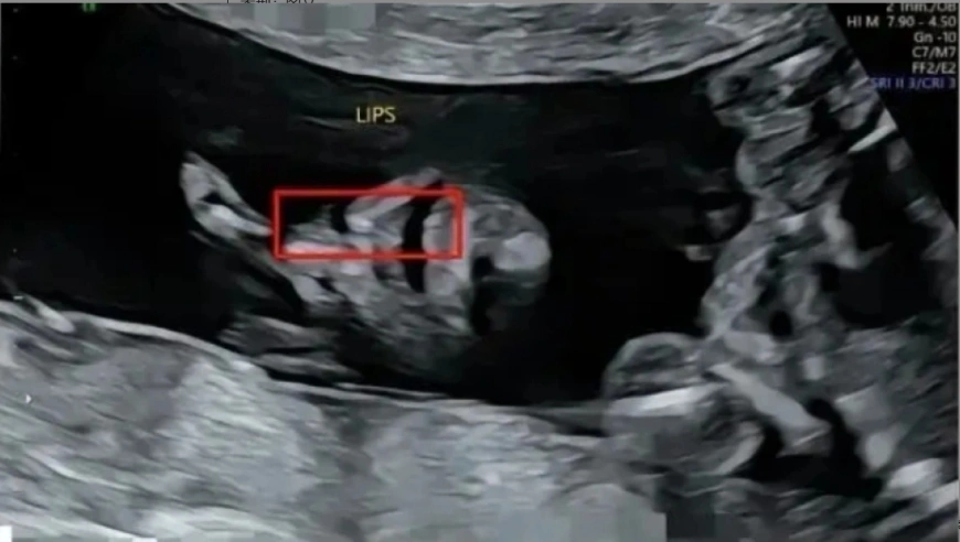 孩子先天畸形 长反映问题遭粗暴对待 桂林市卫生健康委回应